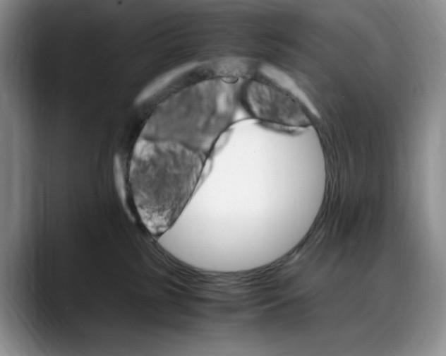 X0000088420185200706121439