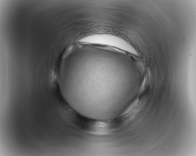 X0000088430176200706051237