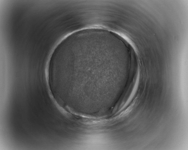 X0000088431054200706051226