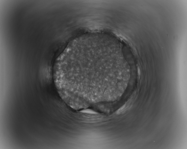 X0000088431156200706121445