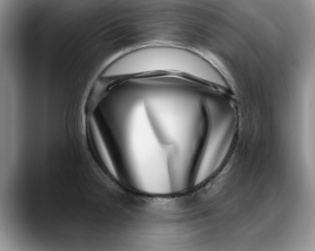 X0000088431238200706121445