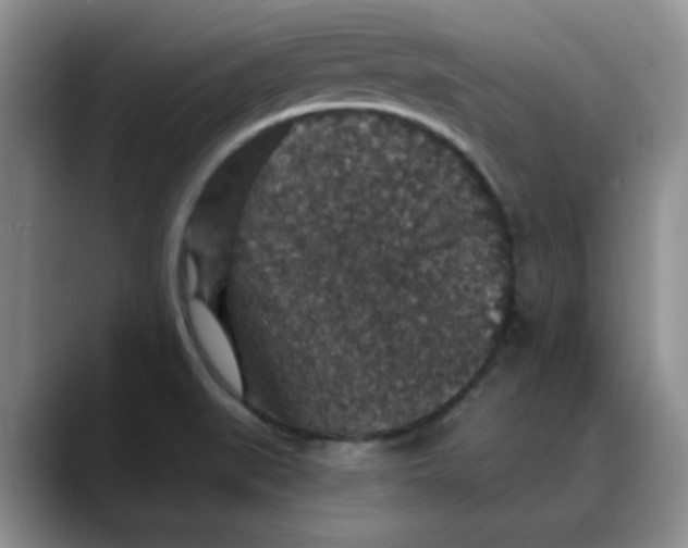 X0000088431519200706121441