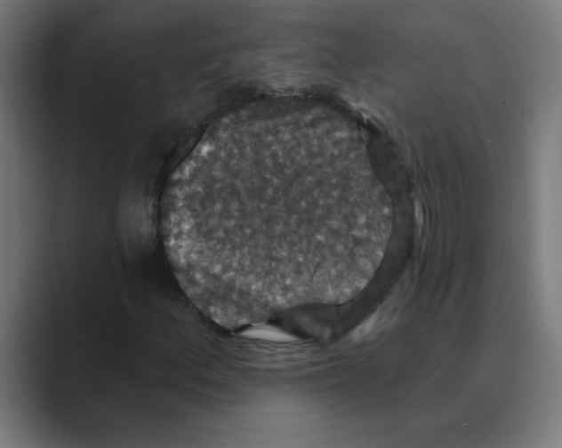 X0000088431156200706191229