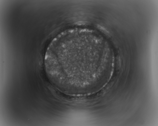 X0000088431158200706191229