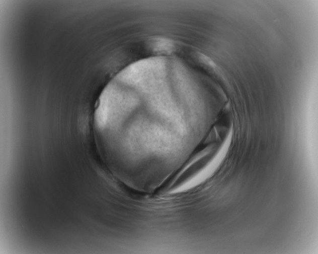 X0000088440379200706051252