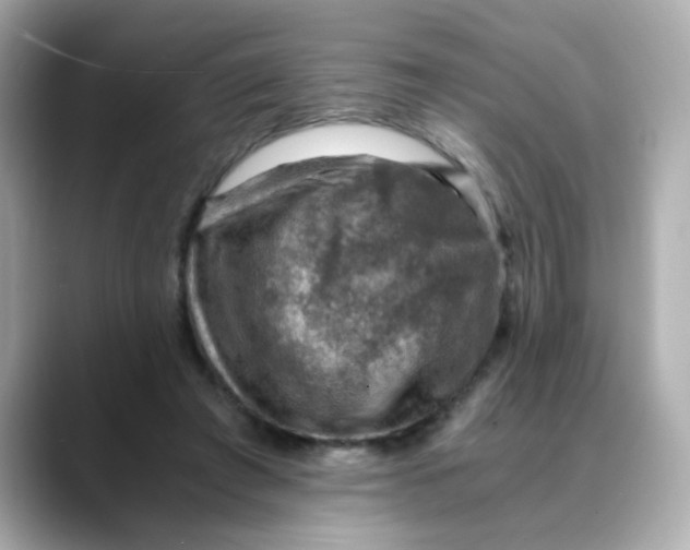 X0000088440401200706051252