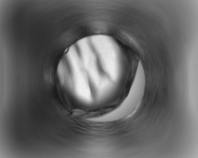 X0000088440170200706121515