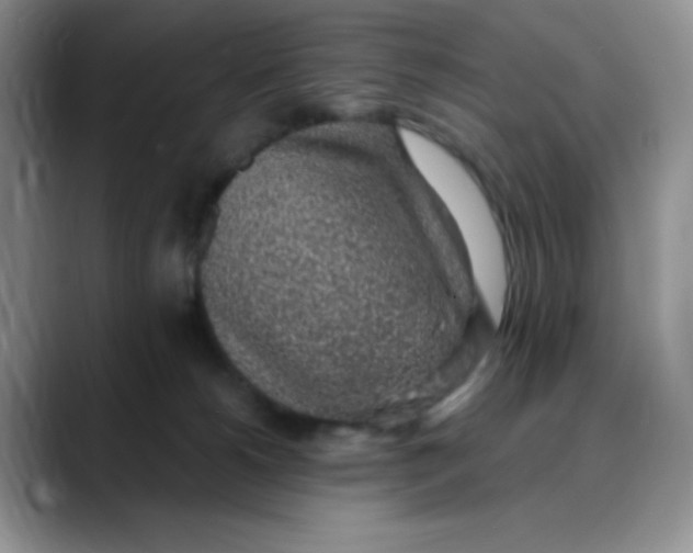 X0000088440180200706121515
