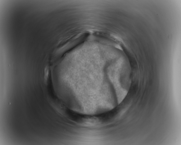 X0000088440215200706121514