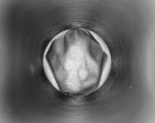 X0000088440418200706121512