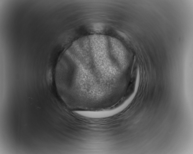 X0000088440562200706121511