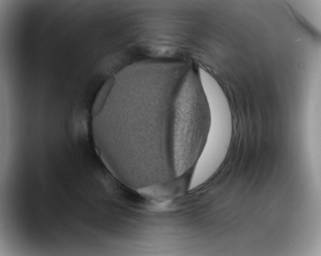 X0000088440570200706121511