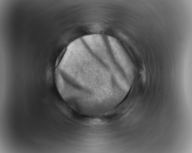 X0000088440572200706121511