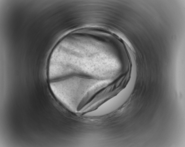 X0000088441148200706121504