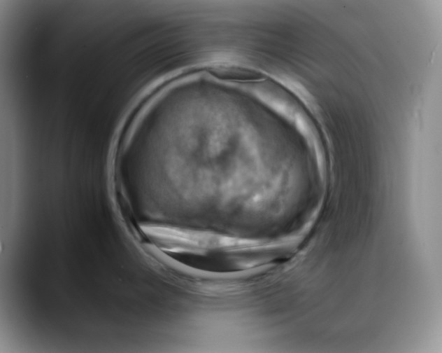 X0000088441392200706121501