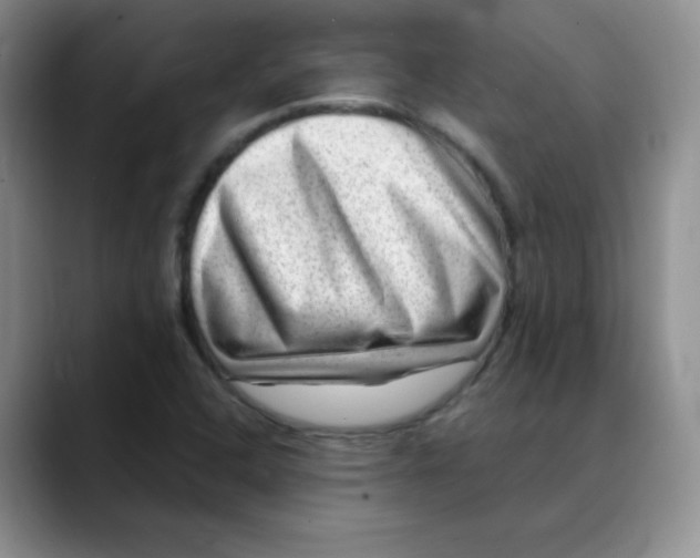X0000088441408200706121500