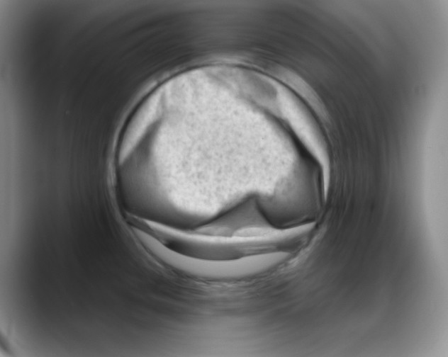 X0000088441436200706121501