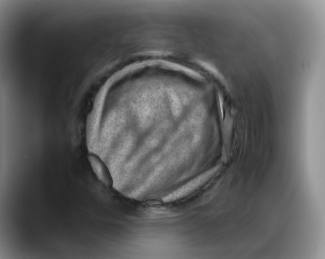 X0000088441448200706121500