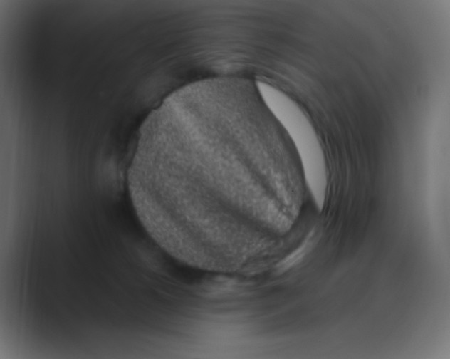 X0000088440180200706191259