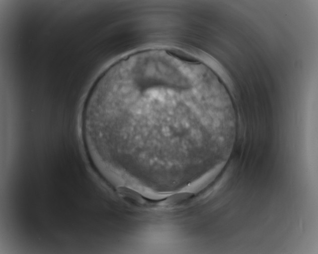 X0000088440958200706191250