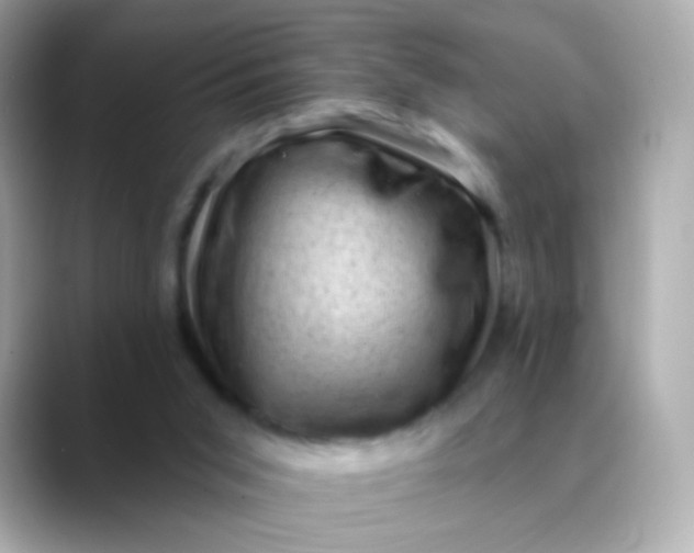 X0000088450015200706051314
