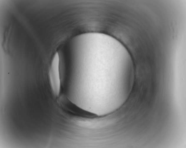 X0000088450017200706051314