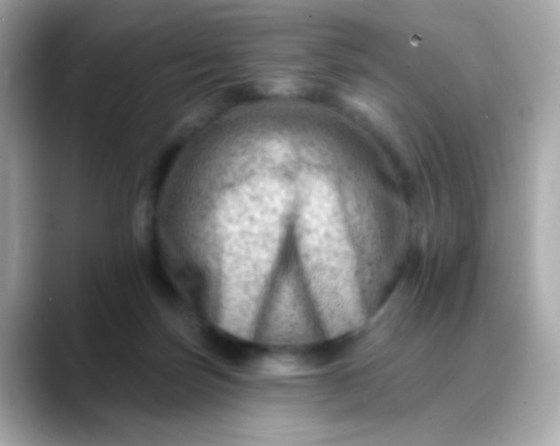 X0000088450171200706051313