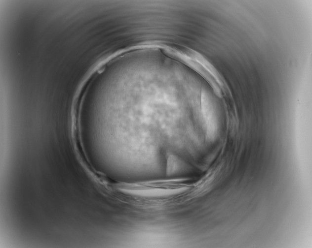 X0000088451101200706051301