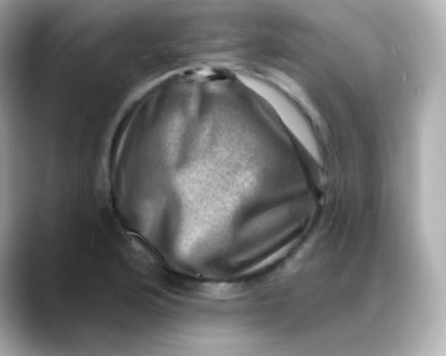 X0000088451176200706051301