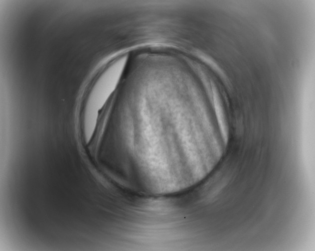 X0000088451416200706051258