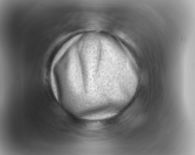 X0000088451454200706051257