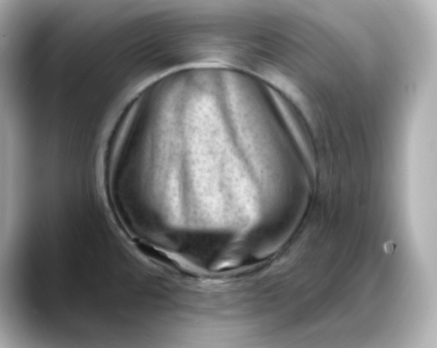 X0000088451480200706051257
