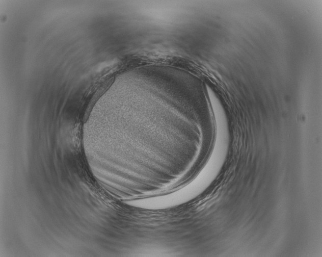 X0000088451156200706121432