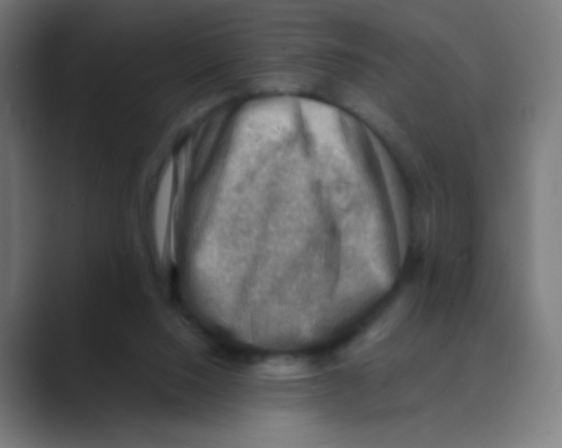 X0000088450064200706191318