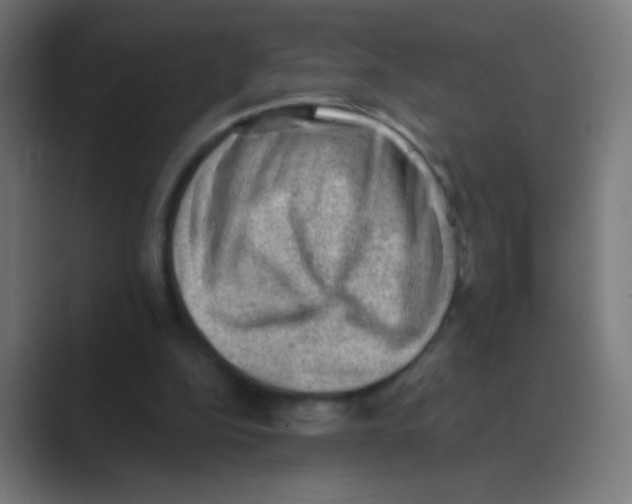 X0000088450152200706191317