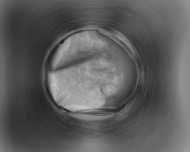 X0000088451101200706191306