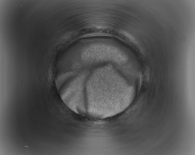 X0000088451110200706191306