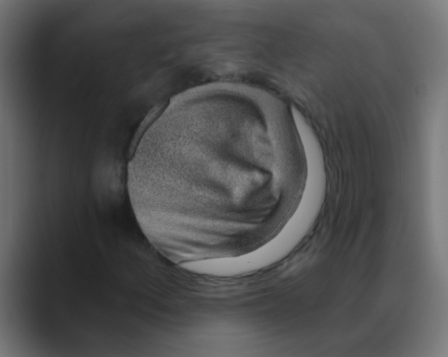 X0000088451156200706191306