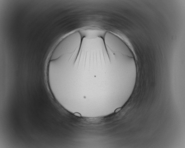 X0000088451488200706191302