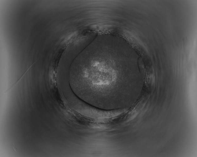 X0000088461010200705221338
