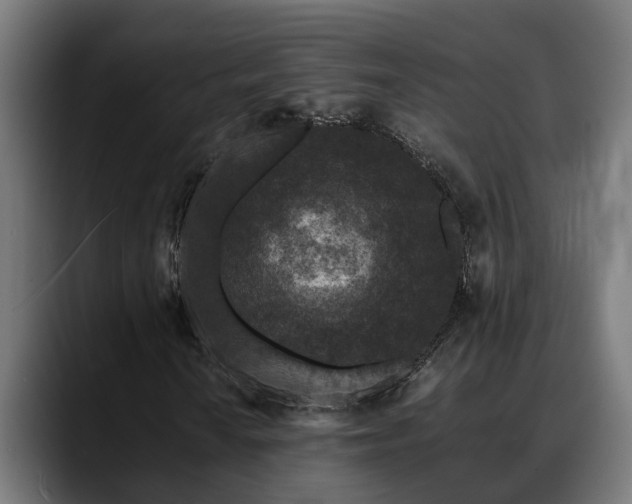 X0000088461010200705291526