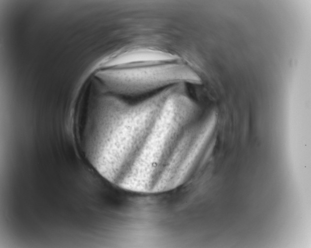 X0000088460100200706051331