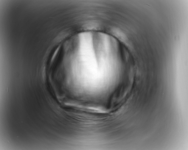 X0000088460250200706051329