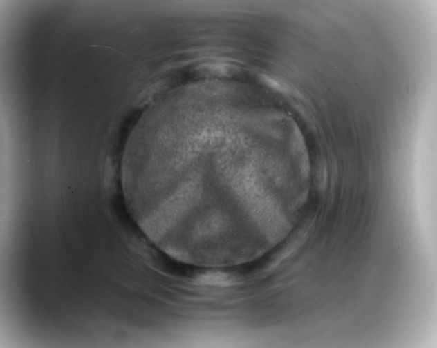 X0000088460759200706051324