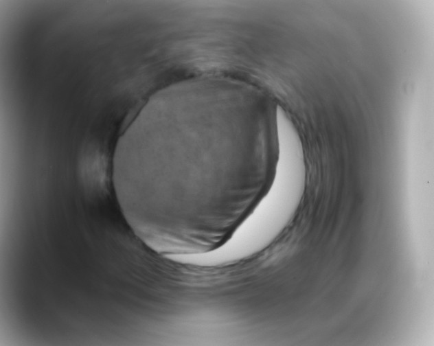 X0000088461156200706051319