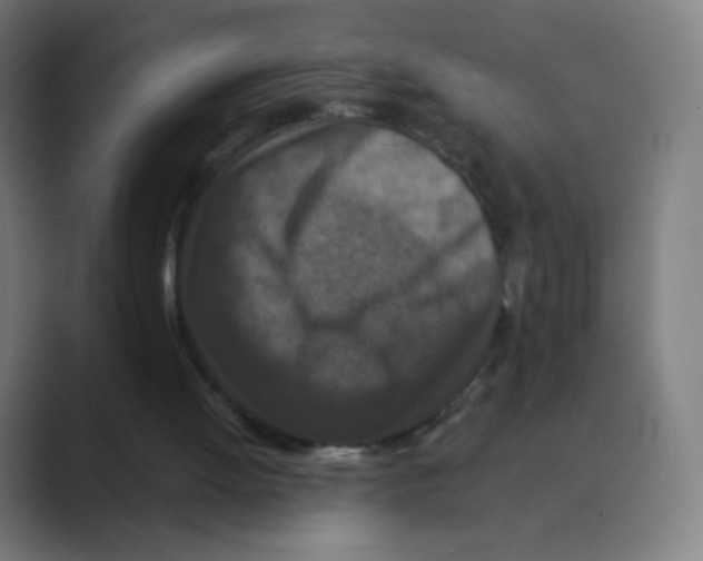 X0000088460052200706191336