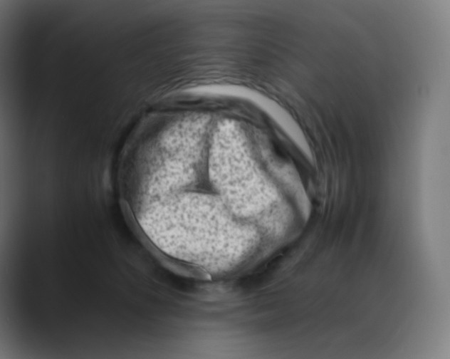 X0000088460516200706191331