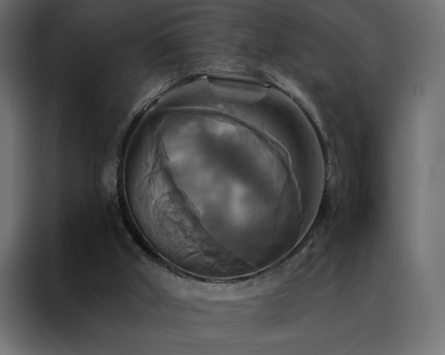 X0000088470010200705221412