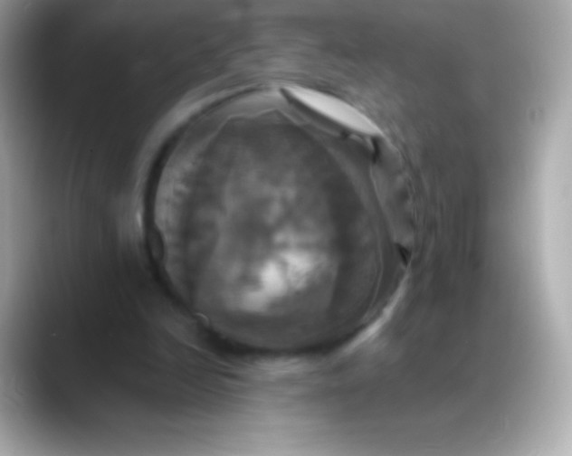 X0000088470246200706051347