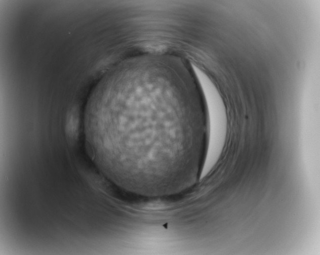 X0000088470600200706051344